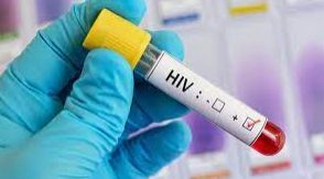 Avances tratamiento VIH
